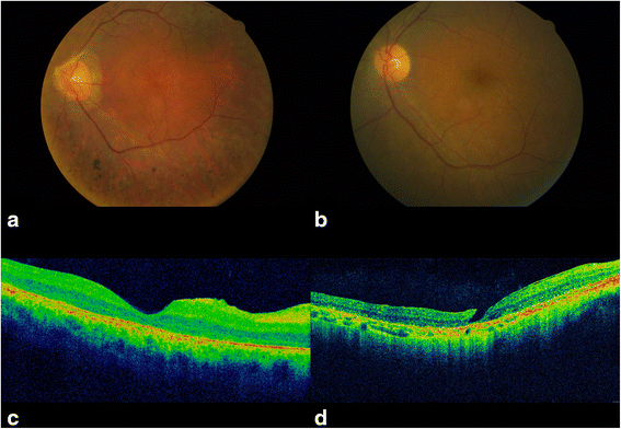 Fig. 2