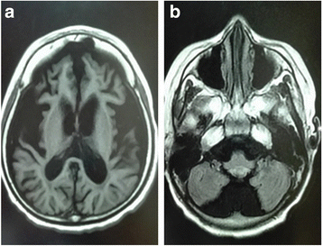 Fig. 1