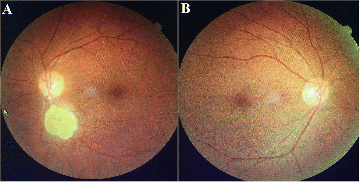 Fig. 4