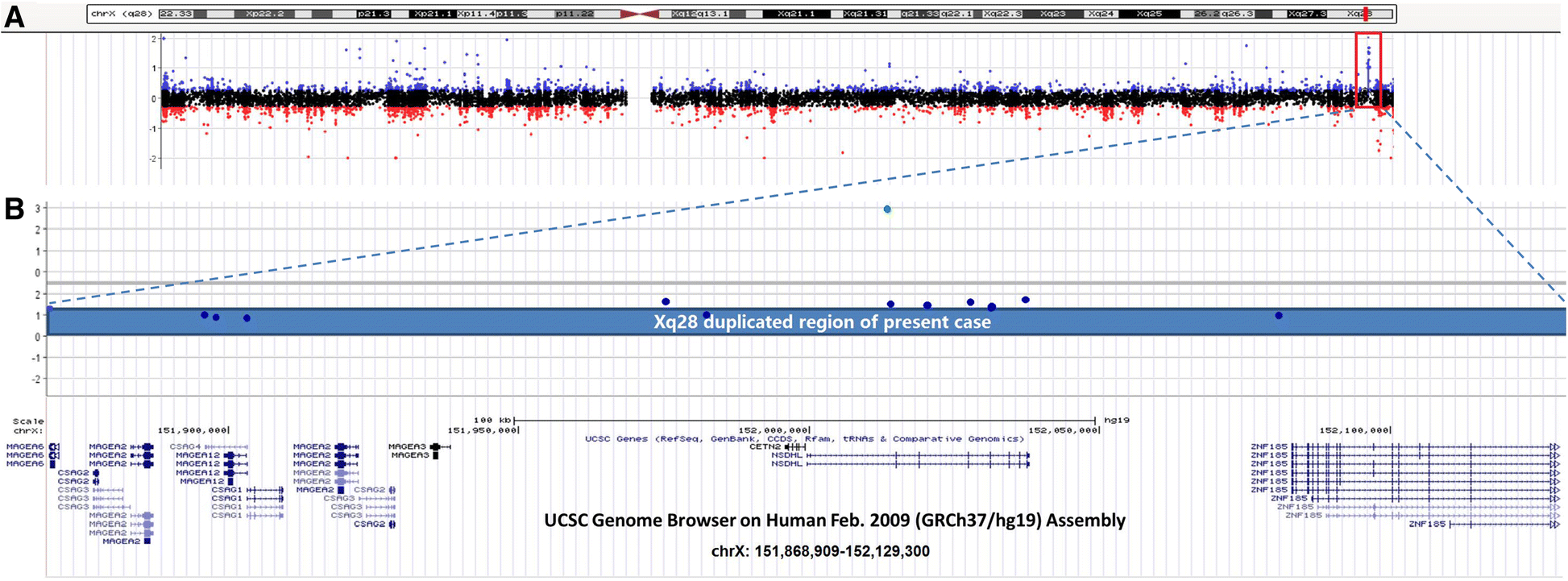 NSDHLcontaining duplication at Xq28 in a male patient with autism