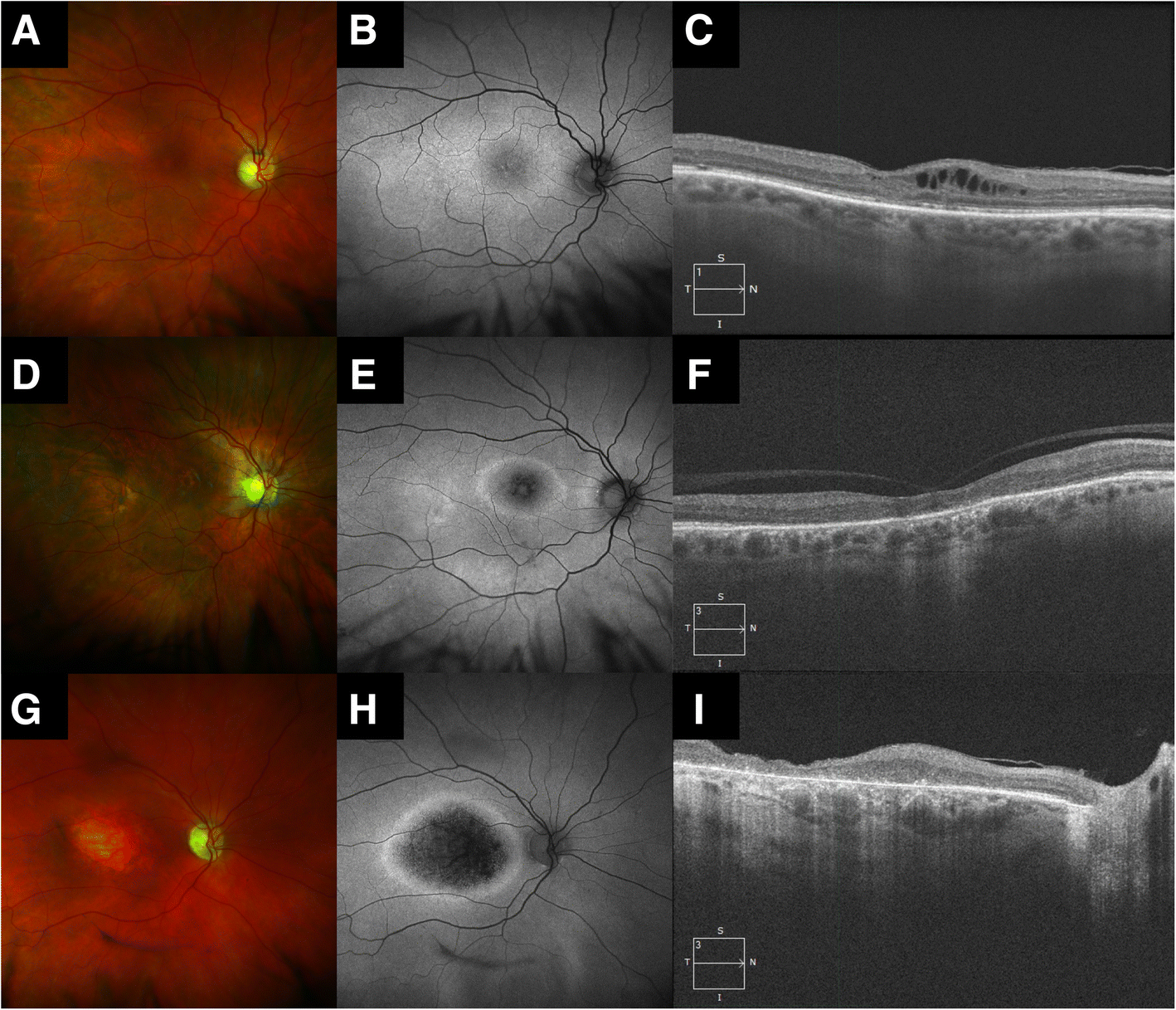 Fig. 2