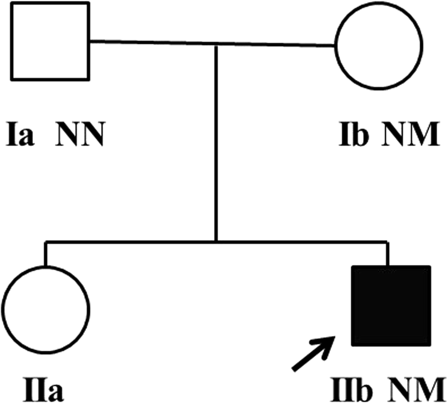 A novel PHKA2 mutation in a Chinese child with glycogen storage disease  type IXa: a case report and literature review | BMC Medical Genetics | Full  Text