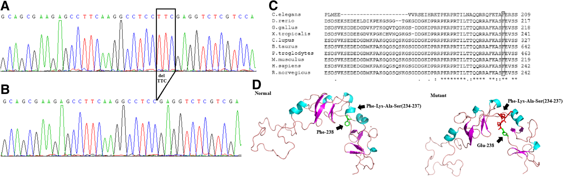 Nail patella syndrome: a review of the phenotype aided by developmental  biology | Journal of Medical Genetics