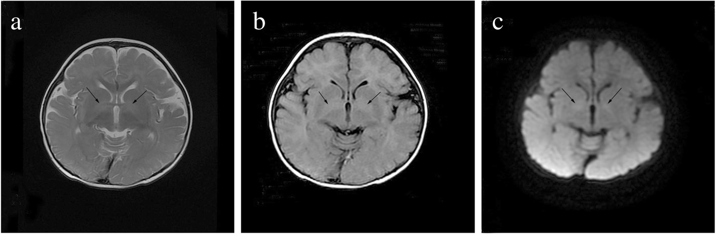 Fig. 1