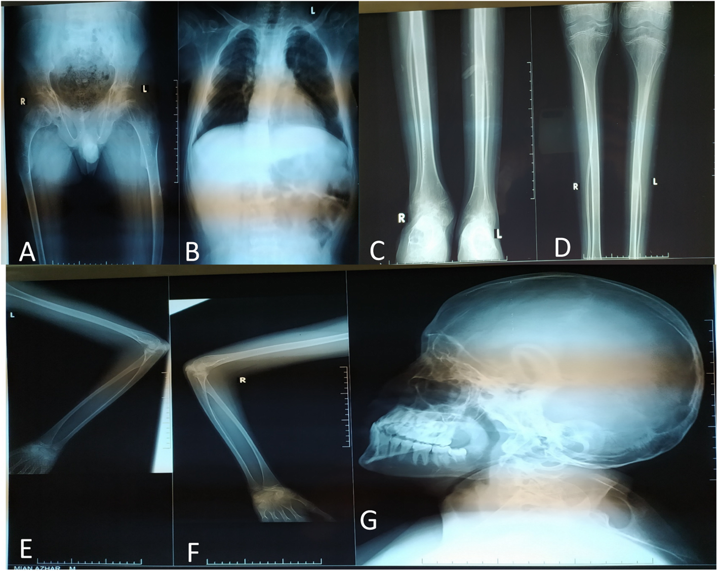 Fig. 4