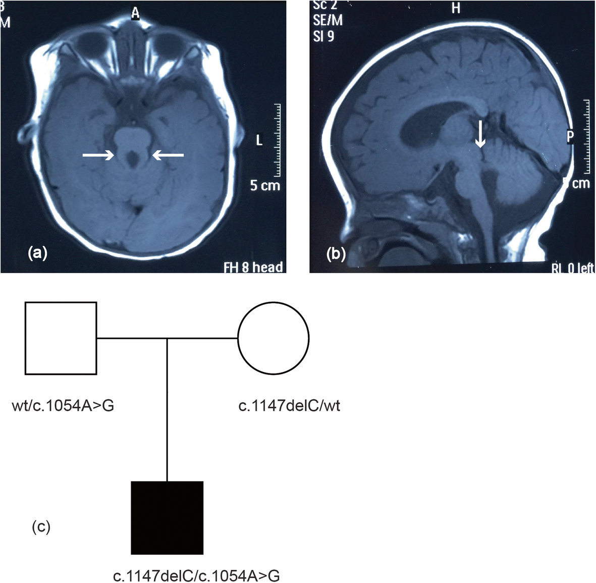 Fig. 1