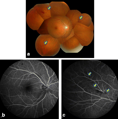 Fig. 4