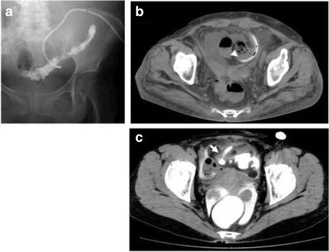 Fig. 1