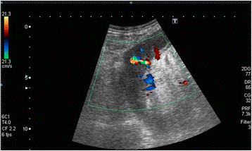 biopsy Anal mapping and