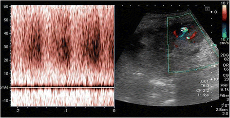 Fig. 2