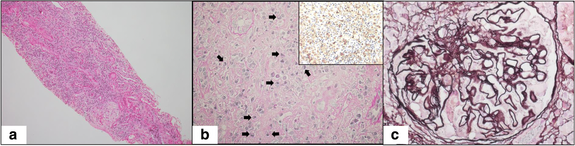 Fig. 1