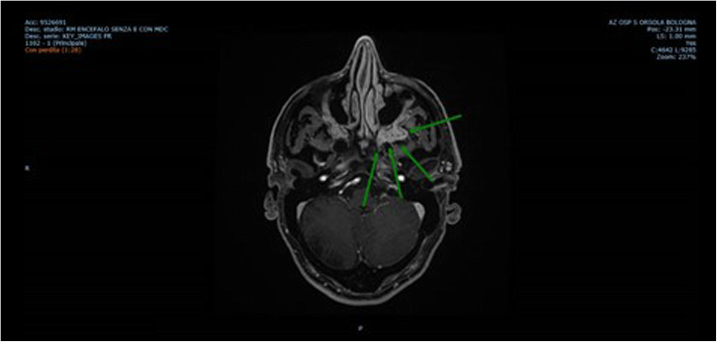 Fig. 4