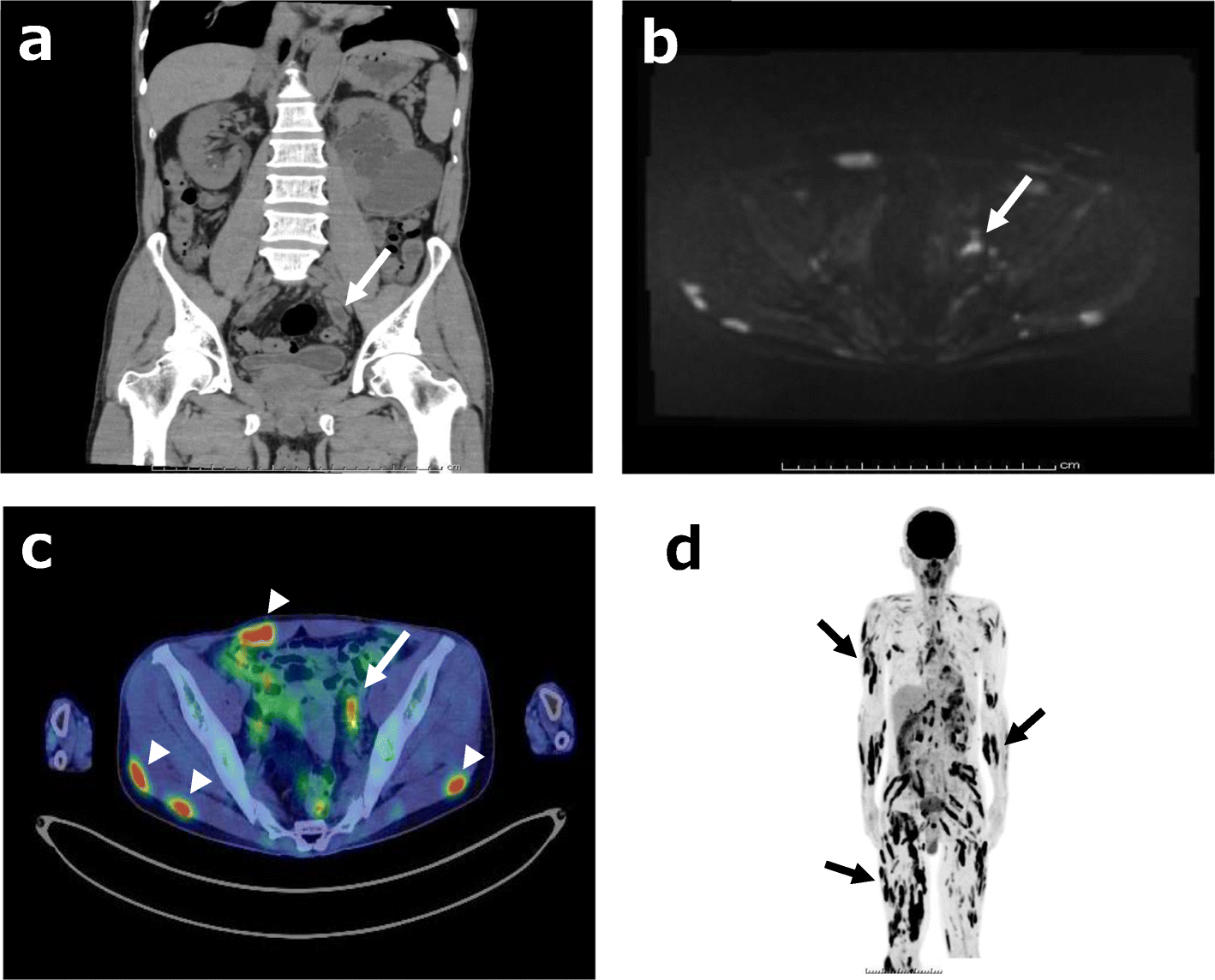 Fig. 1