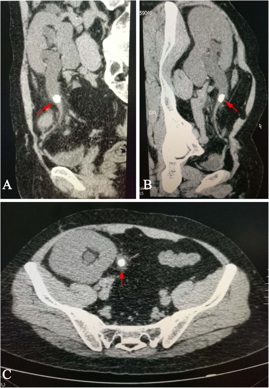 Fig. 2