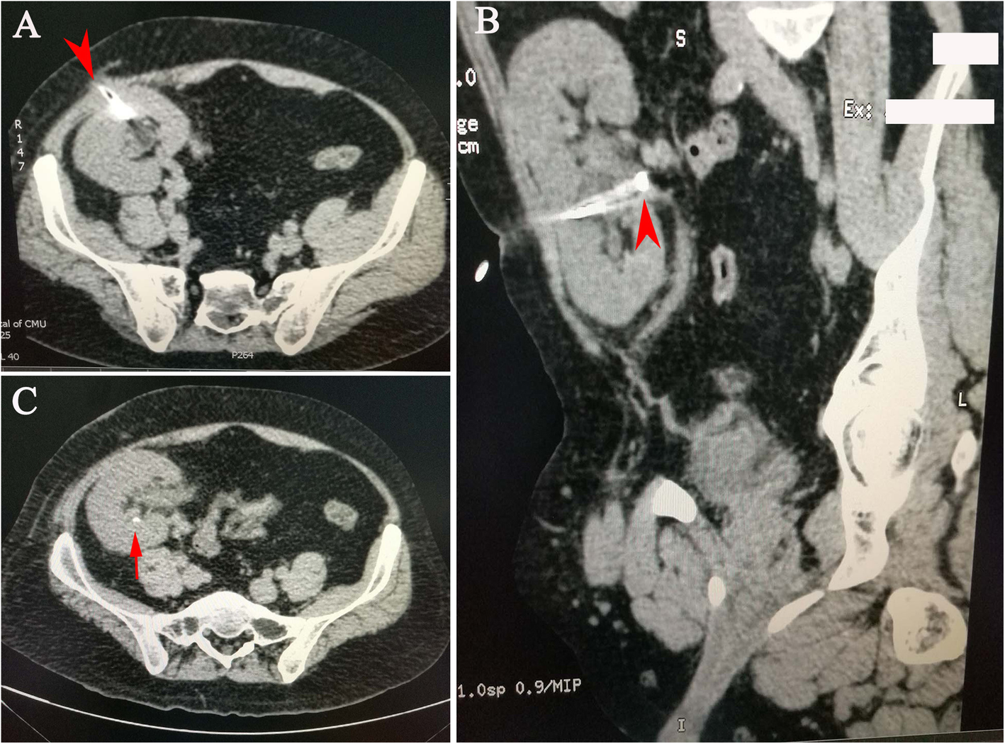 Fig. 3