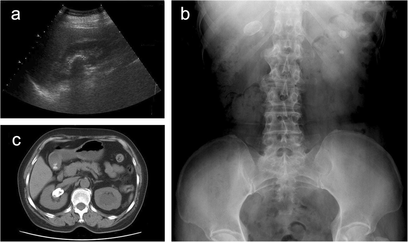 Fig. 1