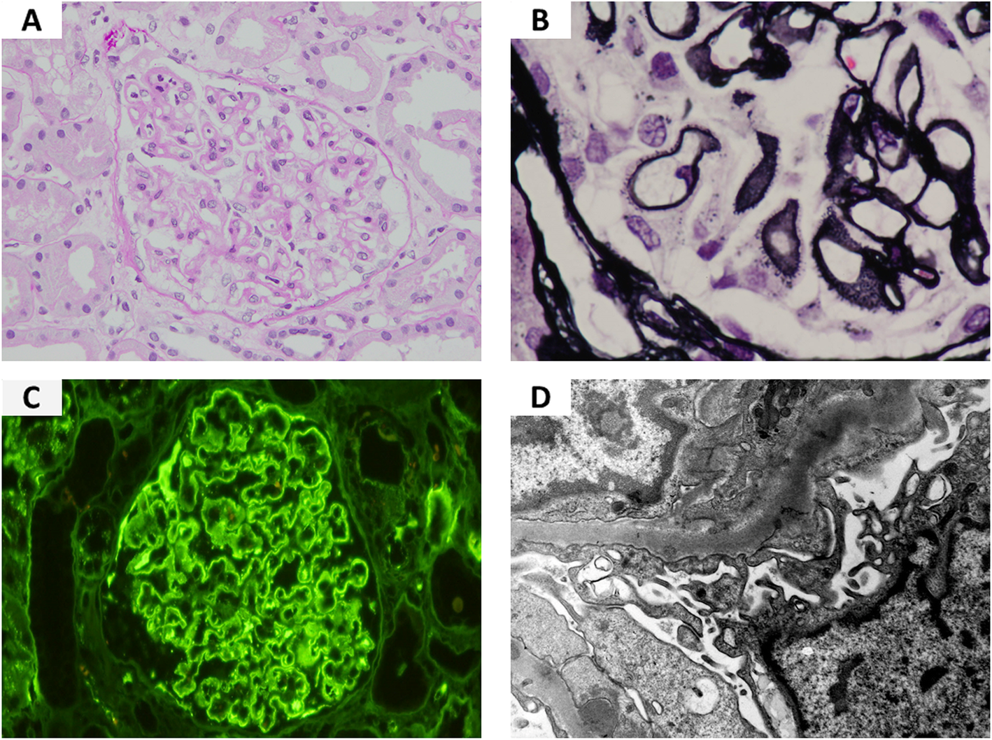 Fig.1