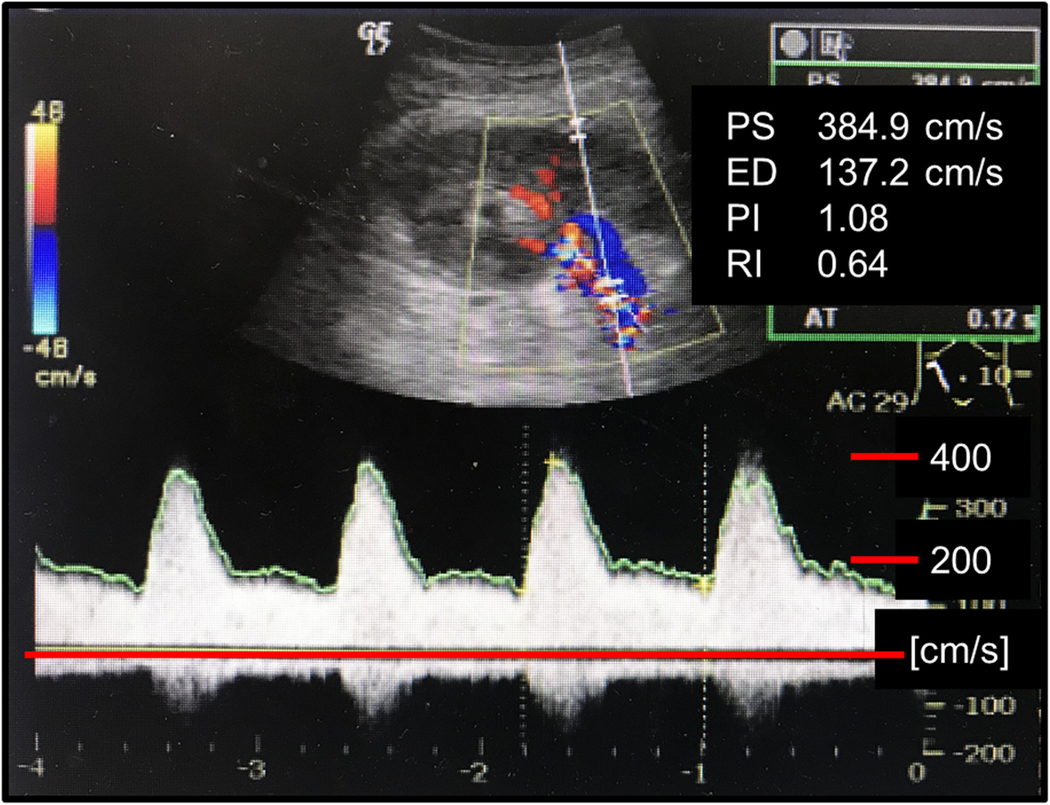 Fig. 2