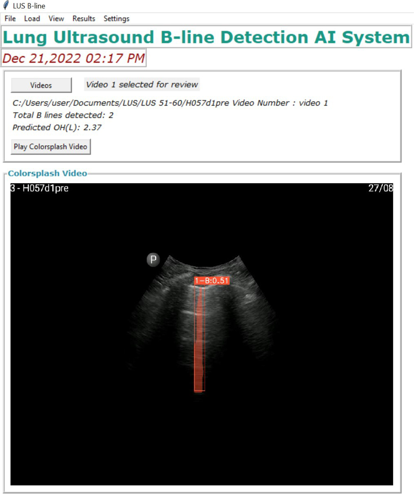 Fig. 2