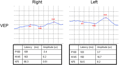 Fig. 5