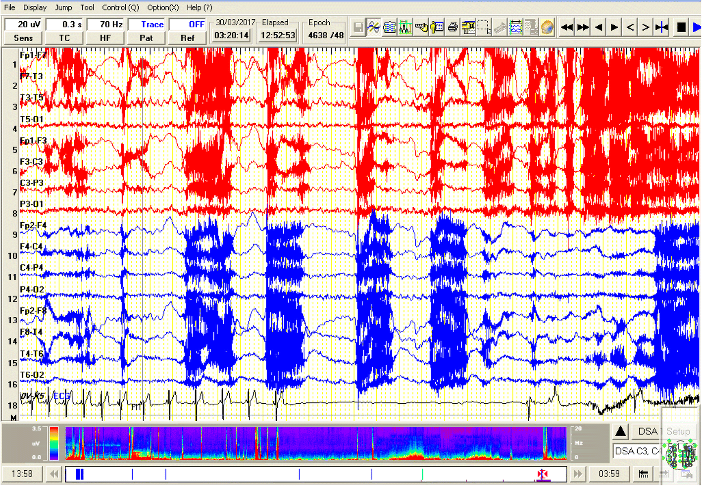 Fig. 2