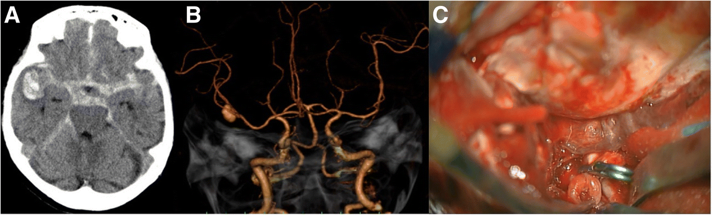 Fig. 1