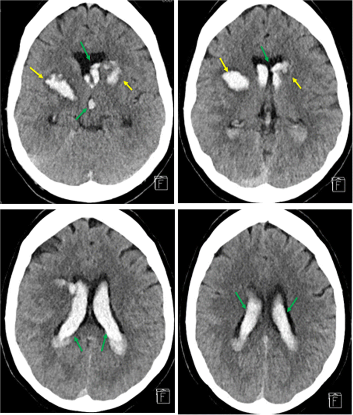 Fig. 2