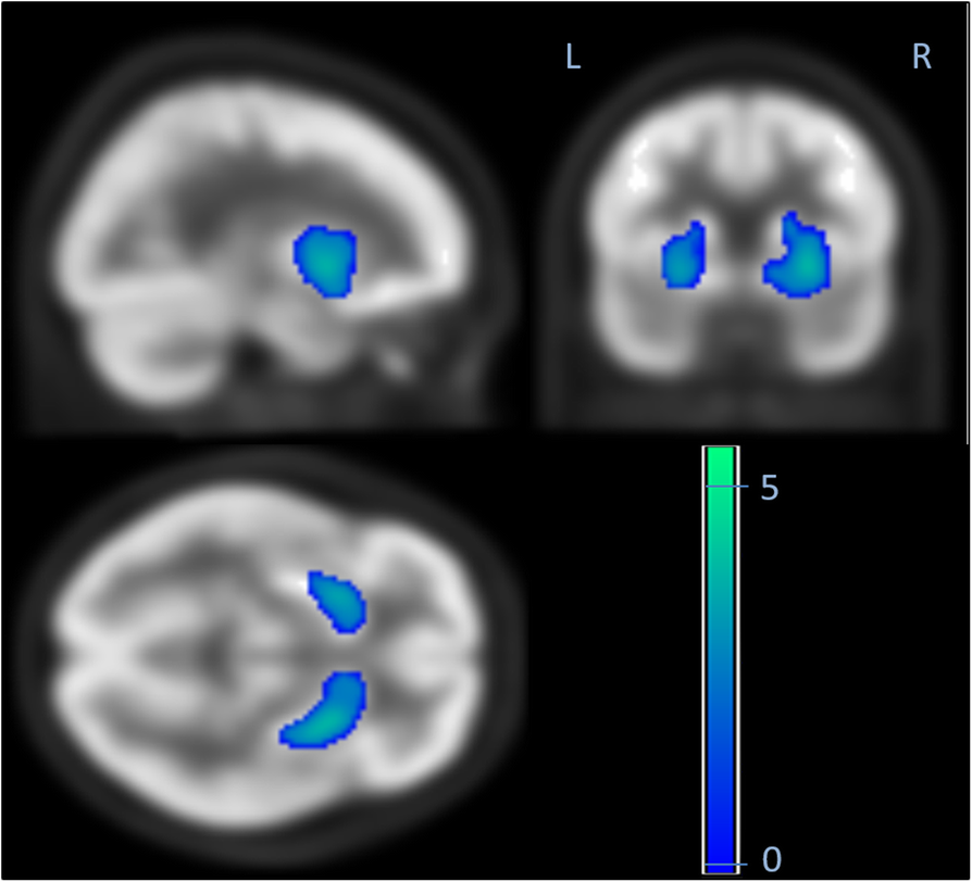 Fig. 3