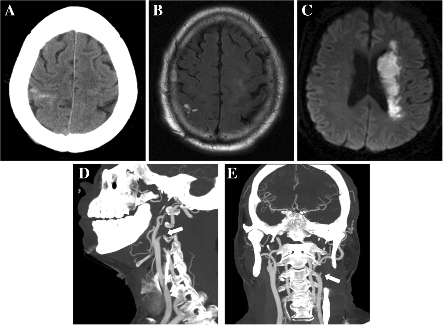 Fig. 1