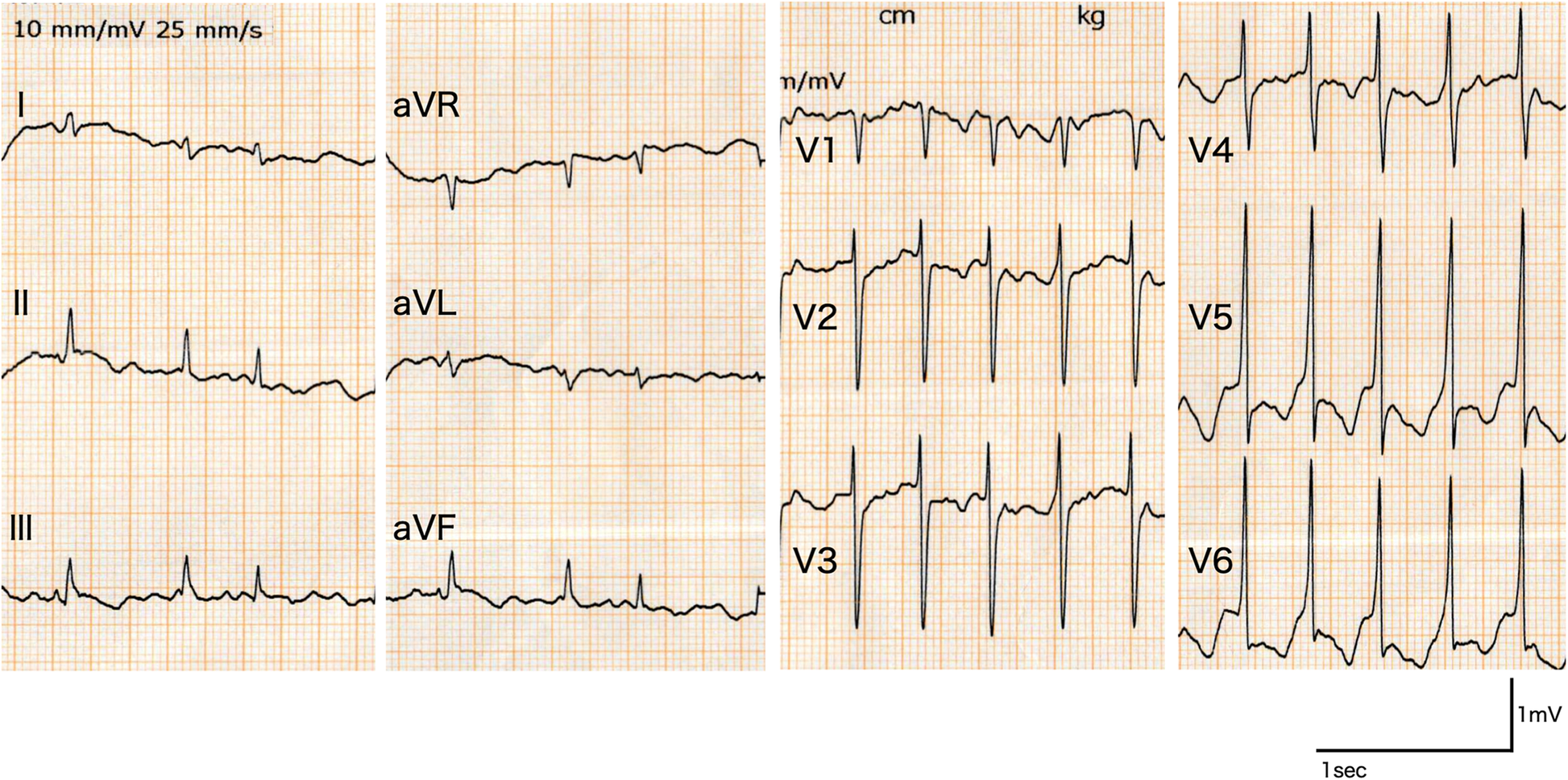 Fig. 1