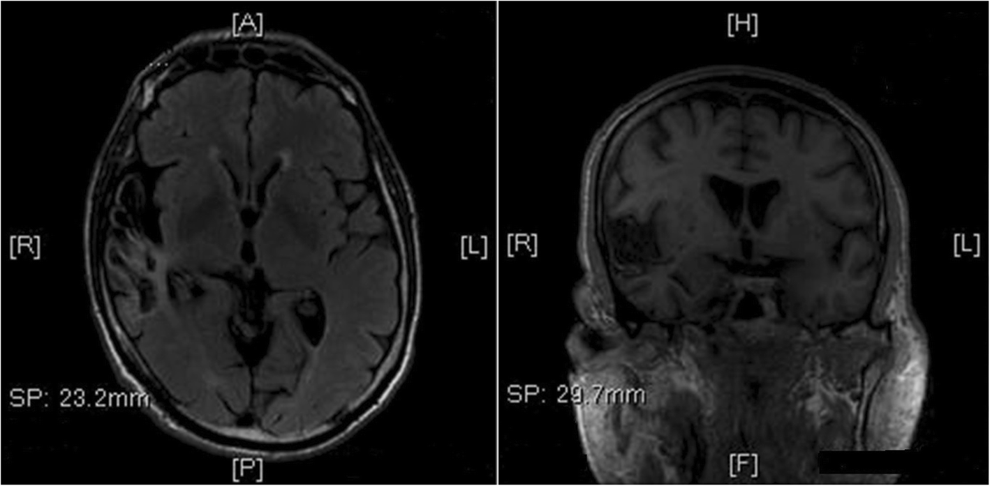 Fig. 2