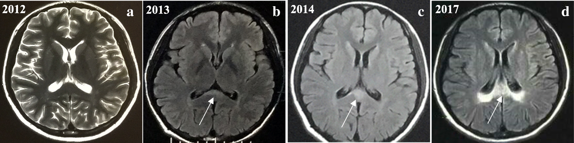 Fig. 4