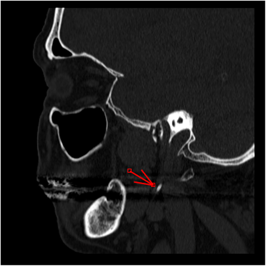 Fig. 5