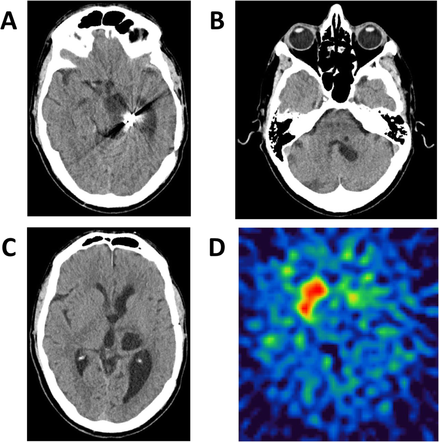 Fig. 2