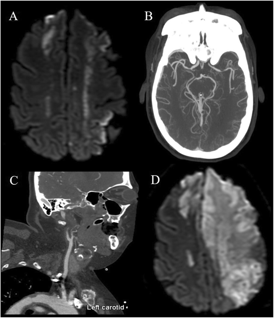 Fig. 1