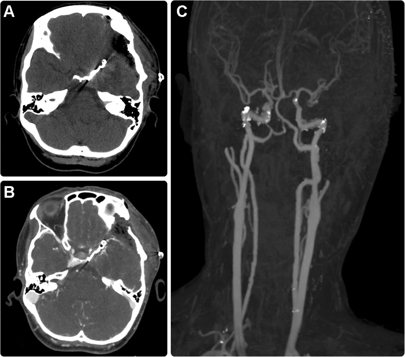 Fig. 4