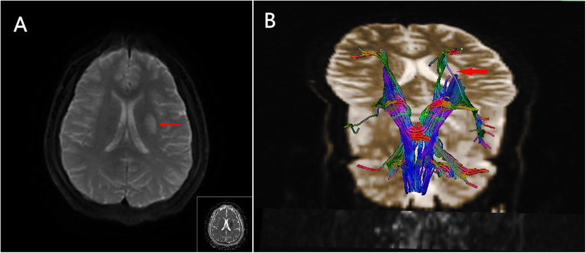 Fig. 2