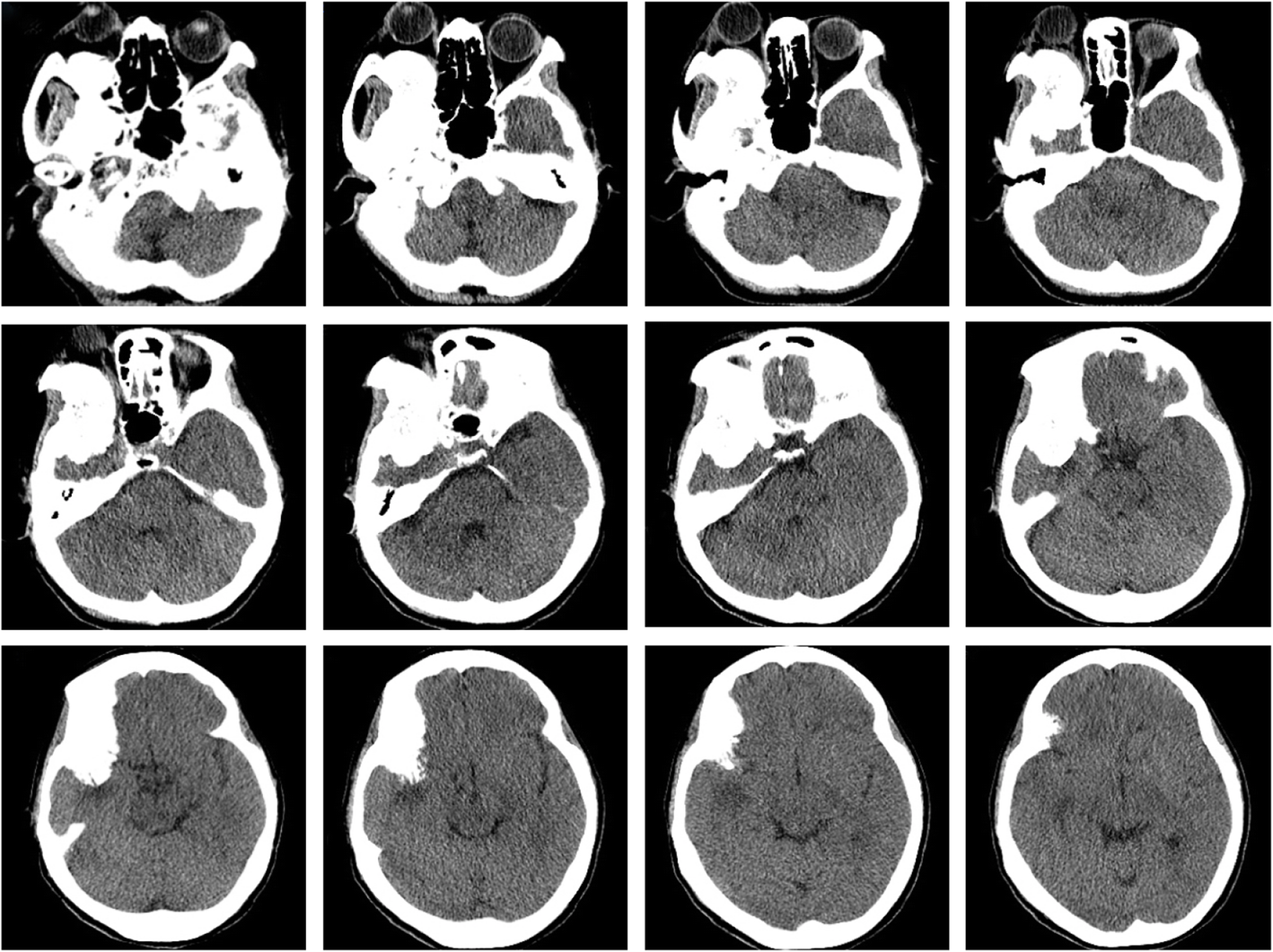 Fig. 1