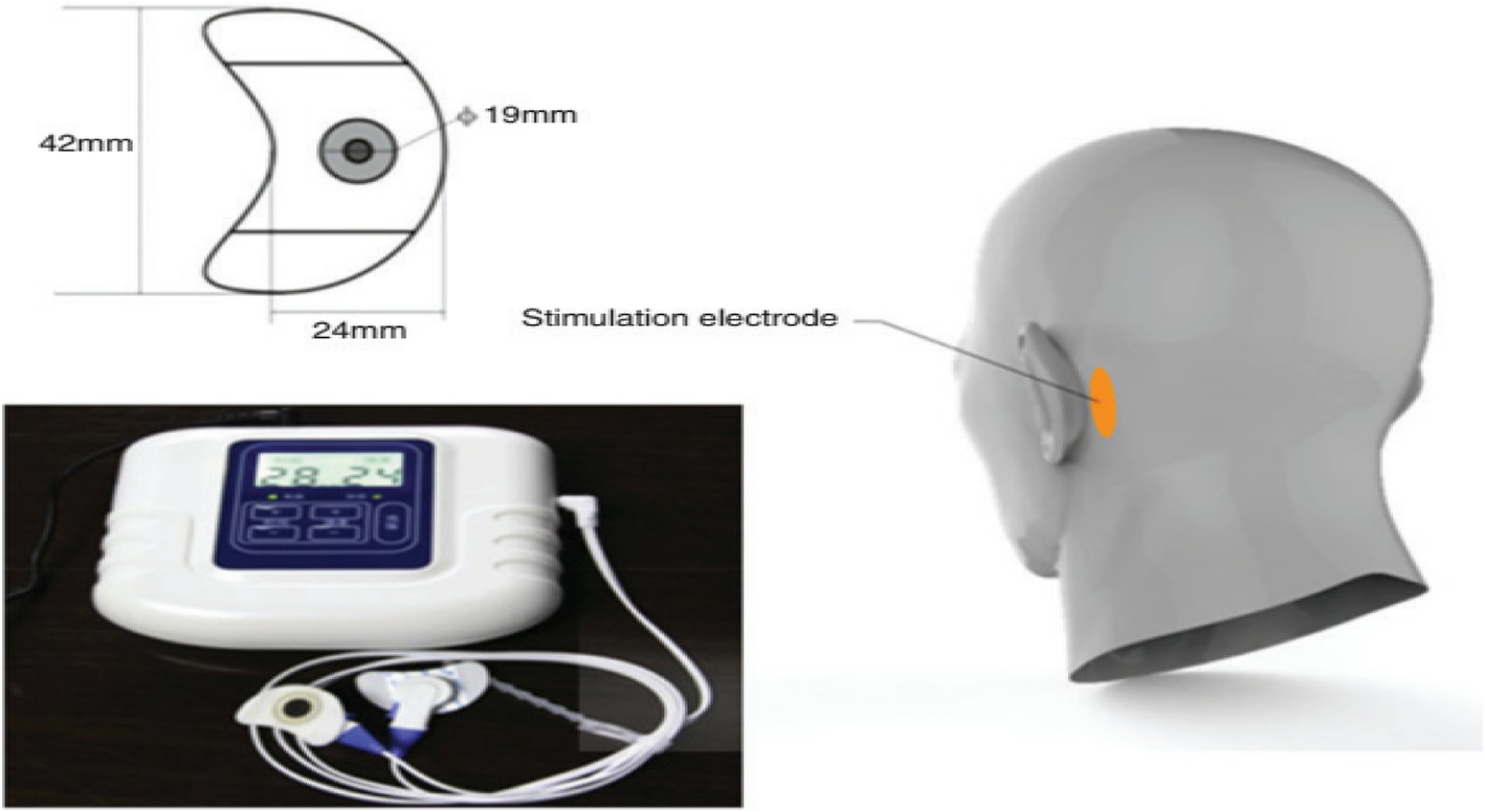 Fig. 1