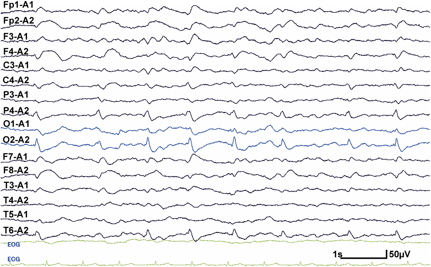 Fig. 2