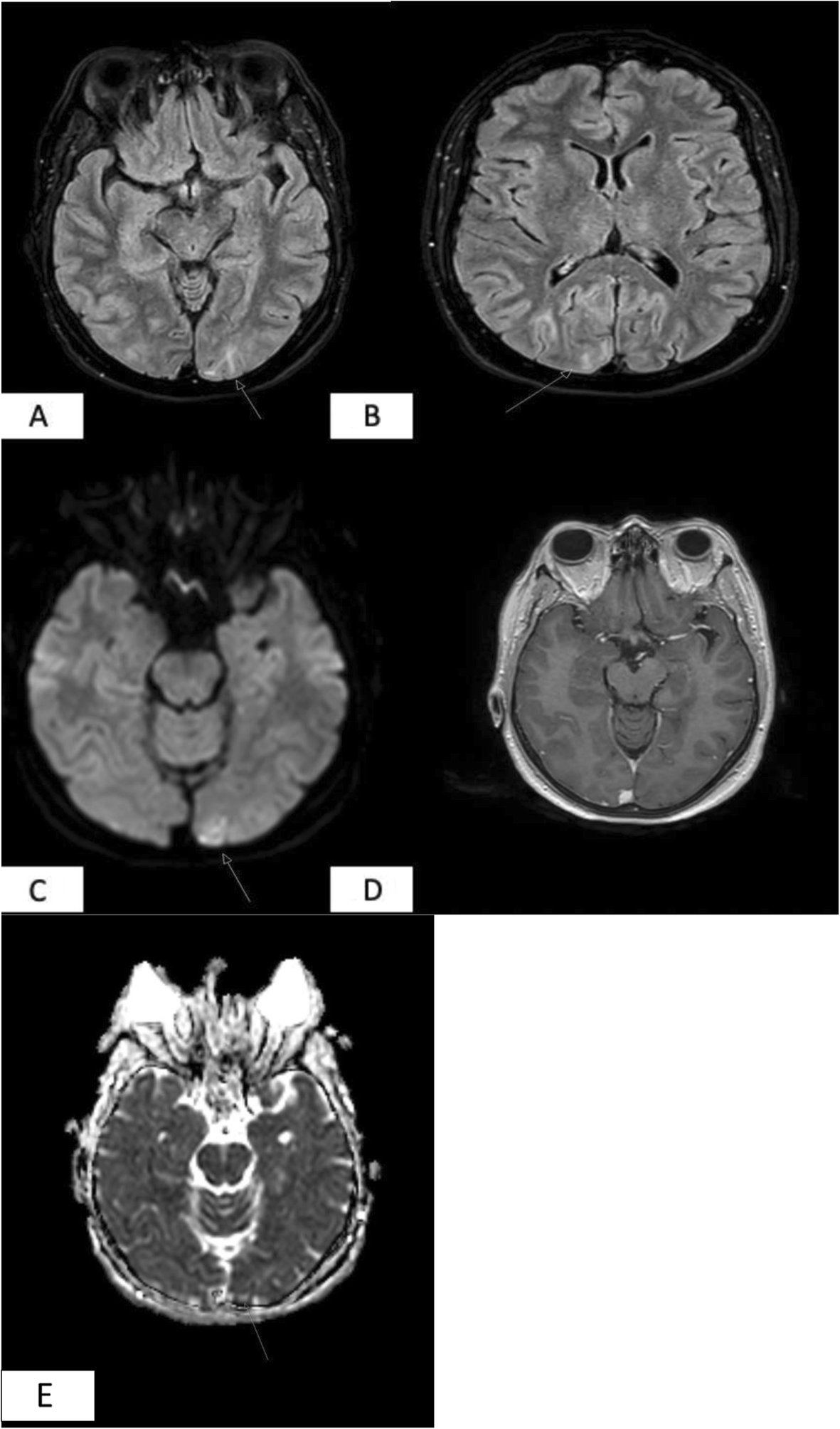 Fig 1