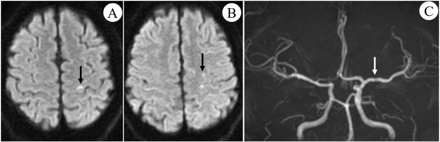 Fig. 1