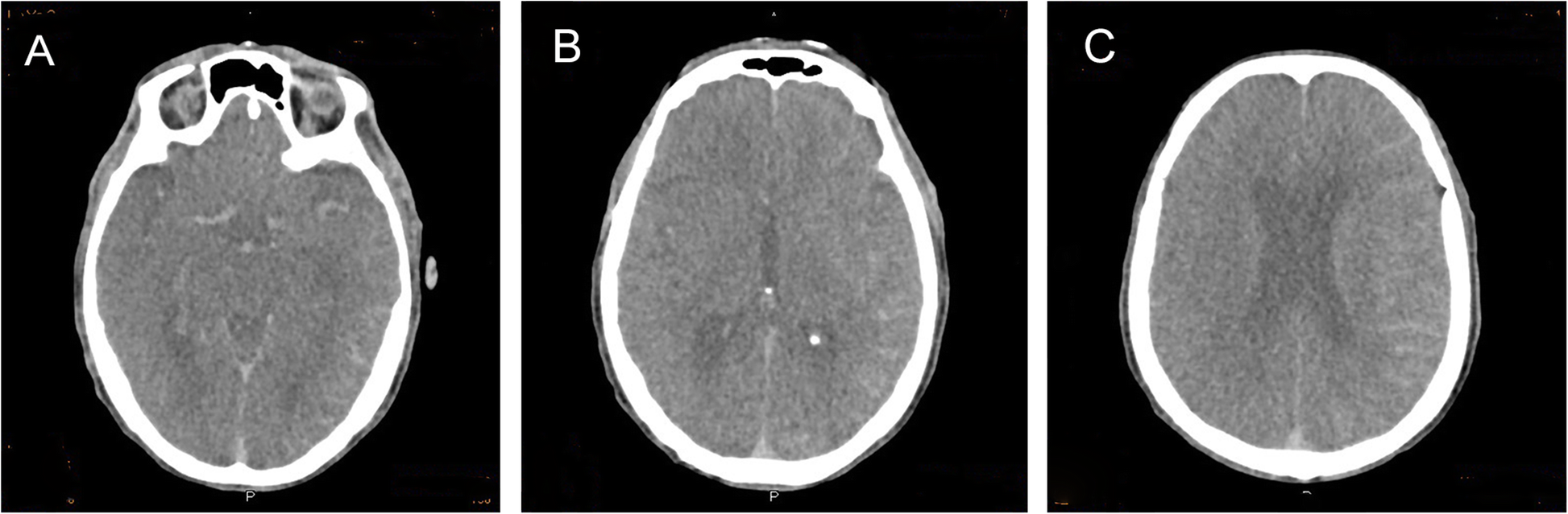 Fig. 2