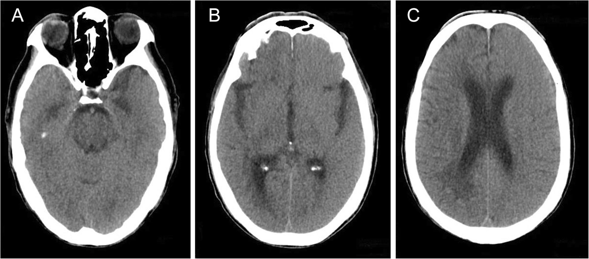 Fig. 4