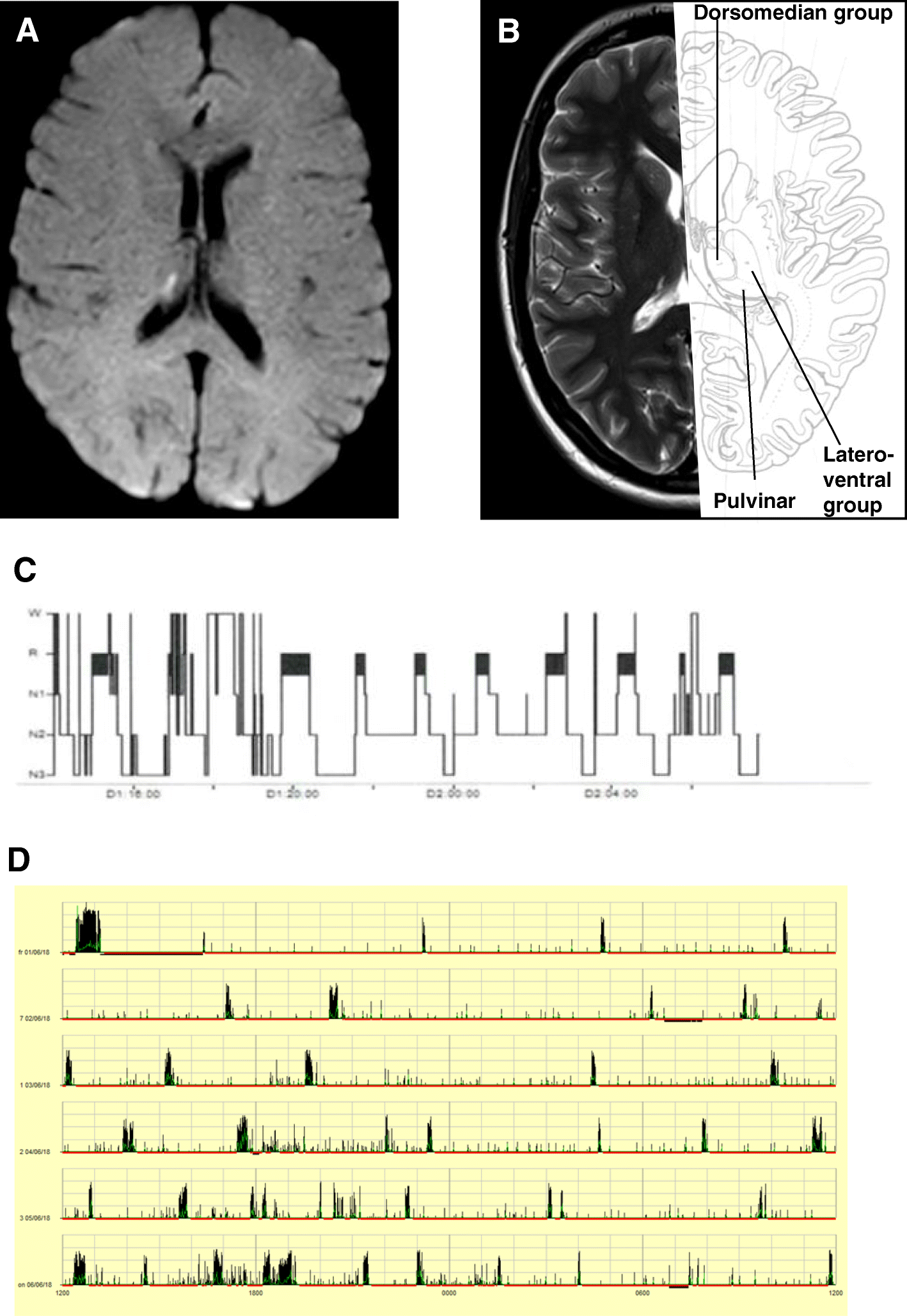 Fig. 1