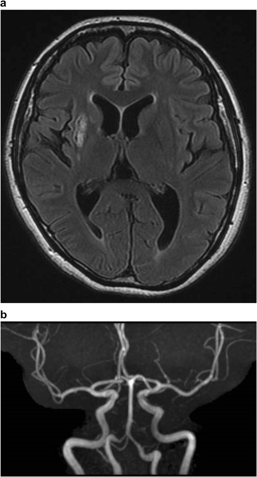 Fig. 6