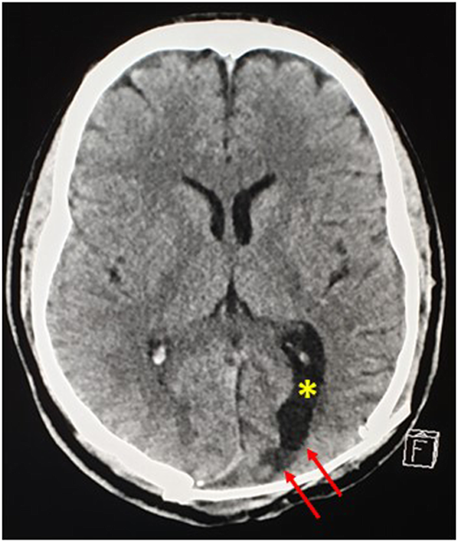 Fig. 12