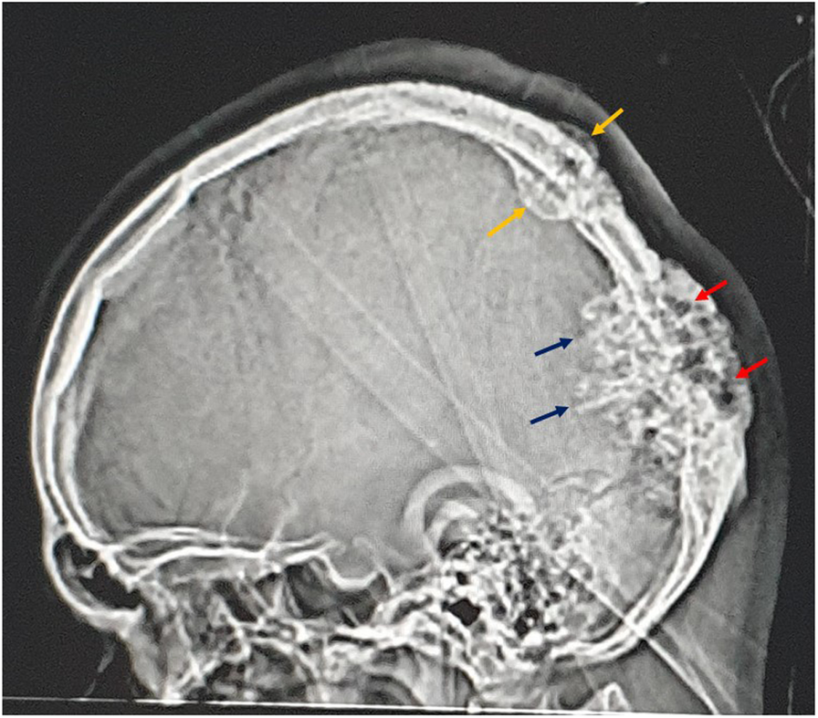 Fig. 1