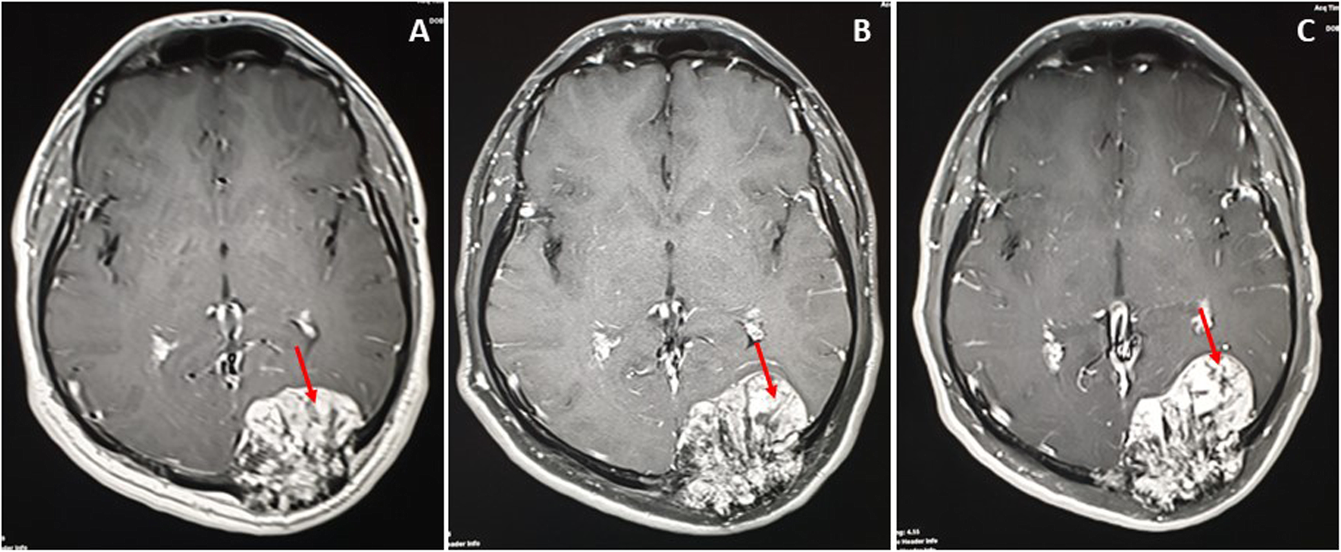 Fig. 5