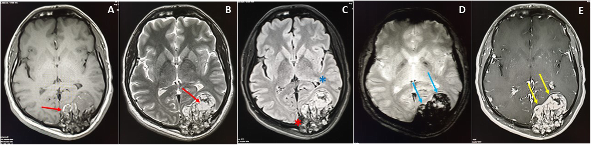 Fig. 6